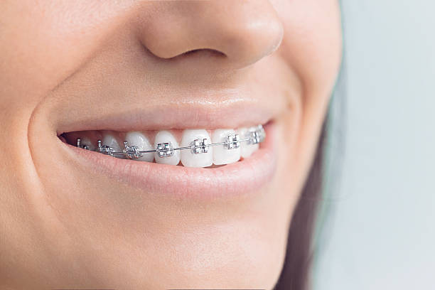 Best Oral Cancer Screening  in Walnut Creek, OH
